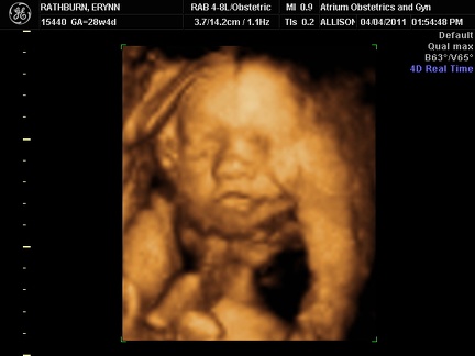 Ultrasound 4April2011b